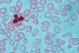 blood